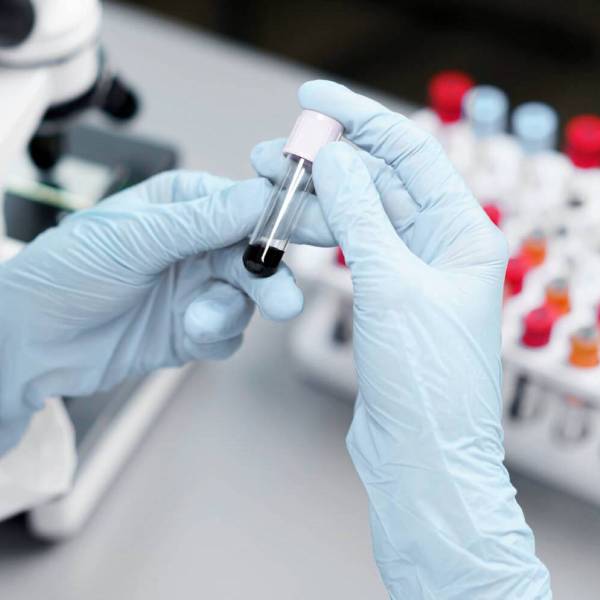hormone tests (1) hormone tests (1)
