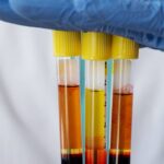 prp bottles prp bottles